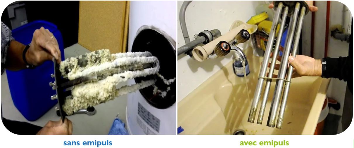 emipuls-avant-après